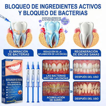 Zoencgz® 💯🍭 Gel antibacteriano para la regeneración de las encías | Resultados visibles en 7 días