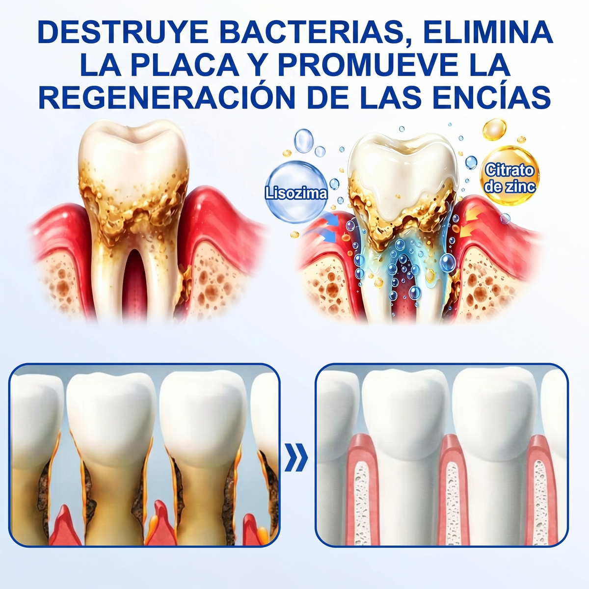 Zoencgz® 💯🍭 Gel antibacteriano para la regeneración de las encías | Resultados visibles en 7 días