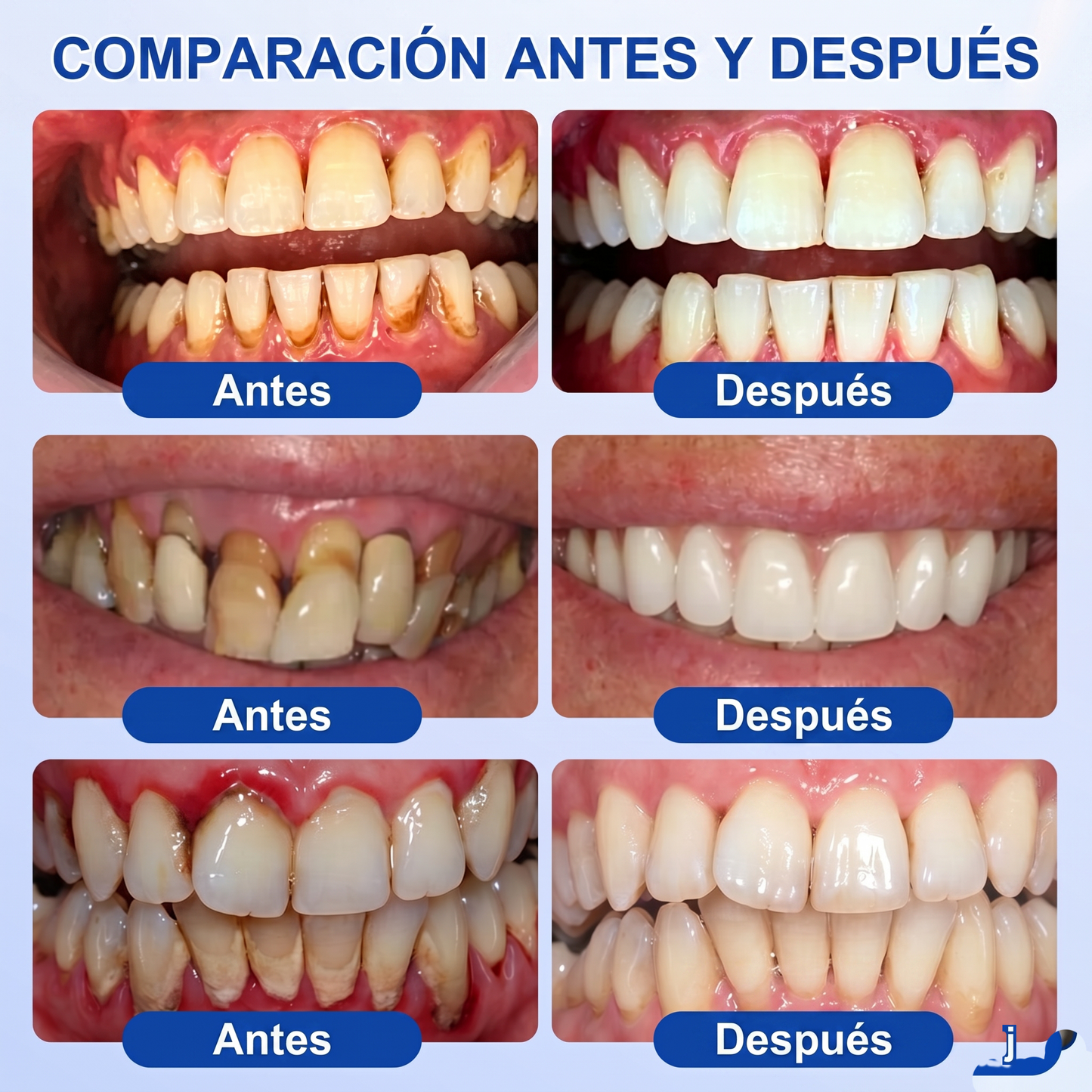 Zoencgz® 💯🍭 Gel antibacteriano para la regeneración de las encías | Resultados visibles en 7 días